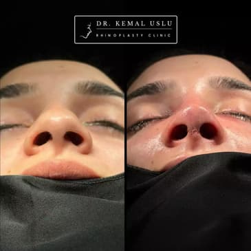 Slider image (2) Dr. Kemal Uslu Clinic